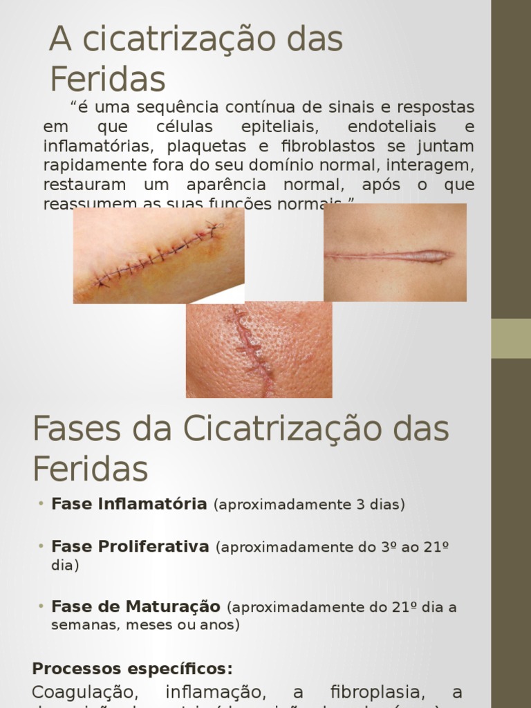 Etapas De Cicatrizacao De Feridas Entenda As Fases De Cicatrização