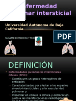 Enfermedad Pulmonar Intersticial 