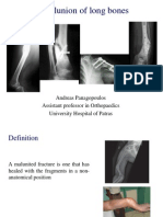 Malunions of Fractures