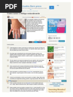 Como Curar o Vitiligo Naturalmente - 10 Passos - UmComo