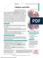 Defectos Tabique Auricular