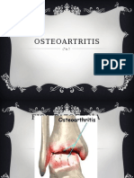 osteoartritis-120311131307-phpapp01