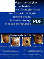 24 II RGE Hernia Hiatala Esofagitele Stenozele Esofagiene