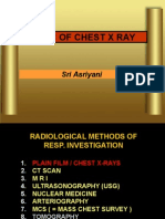 Gambaran Radiologi Penyakit Saluran Napas (Dr. Sri Asriyani, SP - Rad)