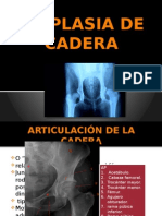 Displasia de cadera: anatomía, ecografía y radiografía