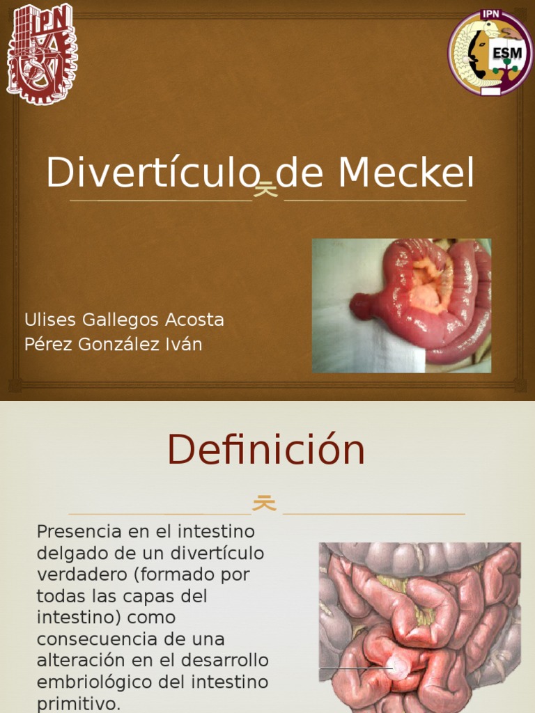 Divertículo de Meckel | Tracto gastrointestinal | Anatomia animal