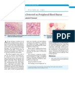 08 PC Klebsiella Bacteremia