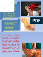 Atm Patologia Capsulitis y Retrodisquitis