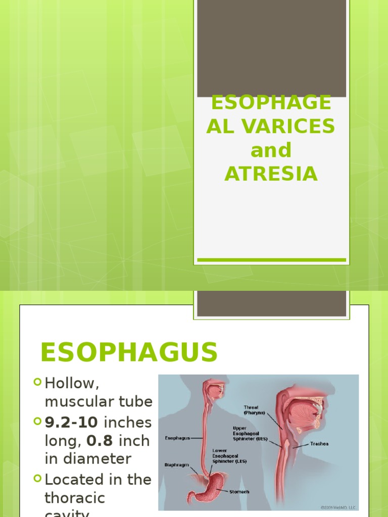 Esophageal Varices and Atresia Esophagus Medical Specialties