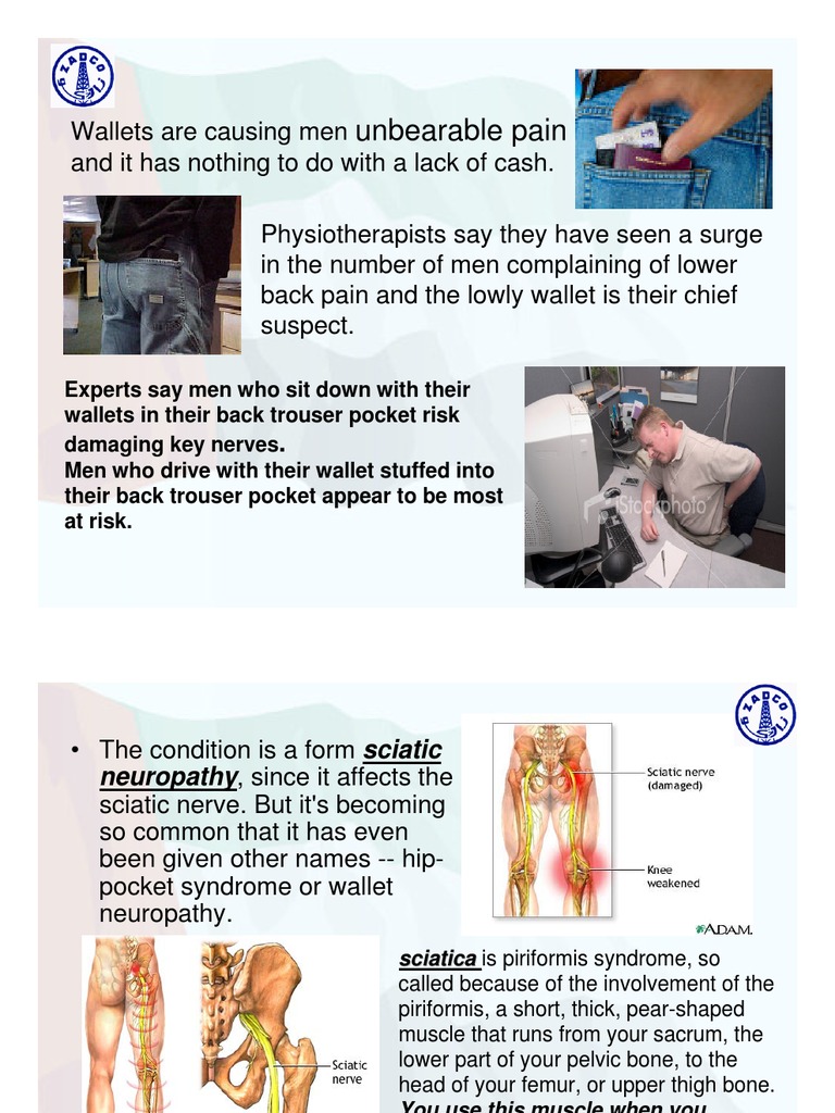 Wallet and Back Pain | PDF | Back Pain | Hip