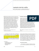 Artroplastia de Rodilla 1