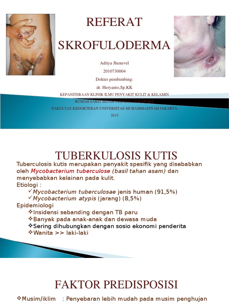 Skrofuloderma | PDF