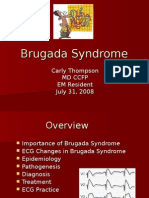 Brugada Syndrome: ECG Changes and Treatment Options