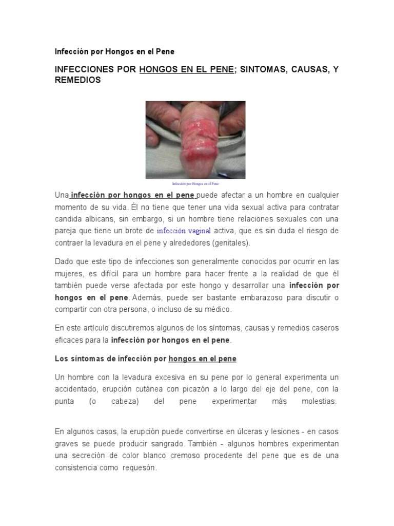 Infección por Hongos en el Pene: Causas y Remedios | PDF | Candidiasis