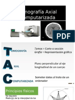 Tomografía Axial Computarizada