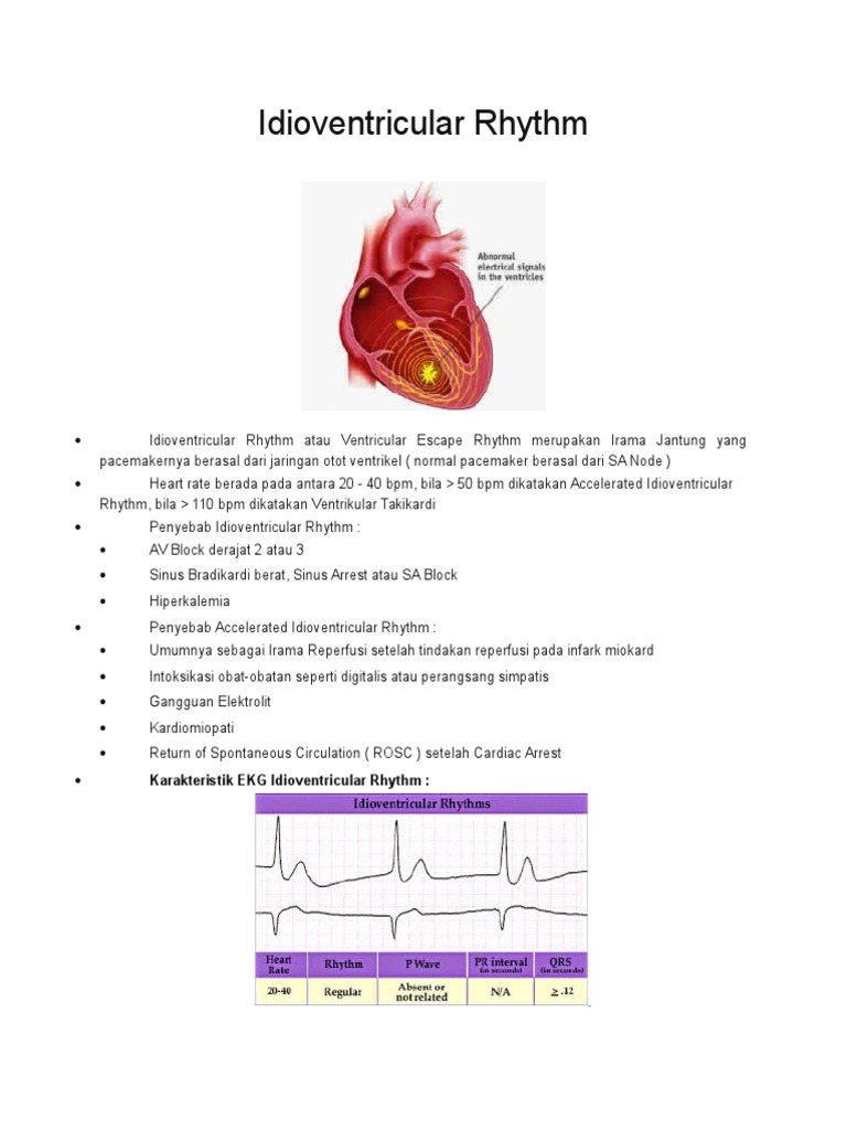 Idioventricular Rhythm | PDF