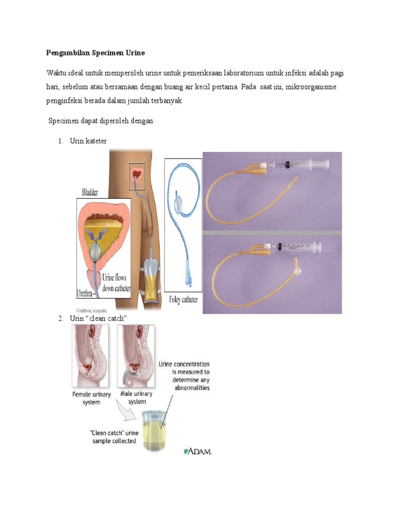 Pengambilan Specimen Urine Idk 3