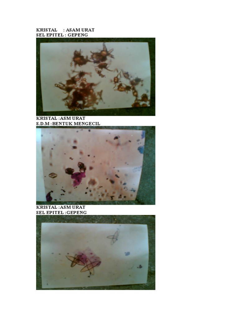 Analisis Sedimen Urin dan Kristal | PDF | Seni