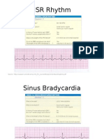 NSR Rhythm: Source: Http://Usasam - Amedd.Army - Mil/ - FM - Course/Study/Understandingecg PDF