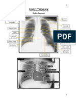 Ringkasan Radiologi