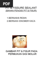 Download Pit  Fissure Sealant Power Point by Dianita Rahma SN290168048 doc pdf