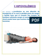 Shock Hipovolémico PDF