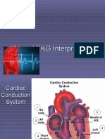 12 Lead EKG Interpretation Guide
