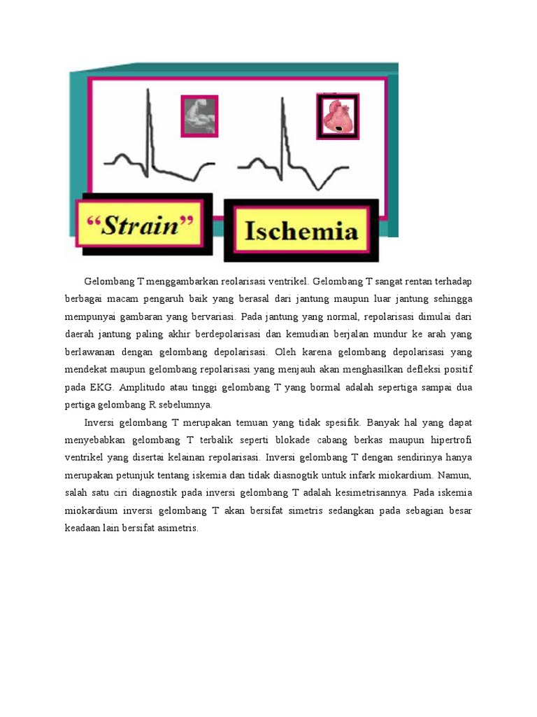 Gelombang T Inversi | PDF | Seni