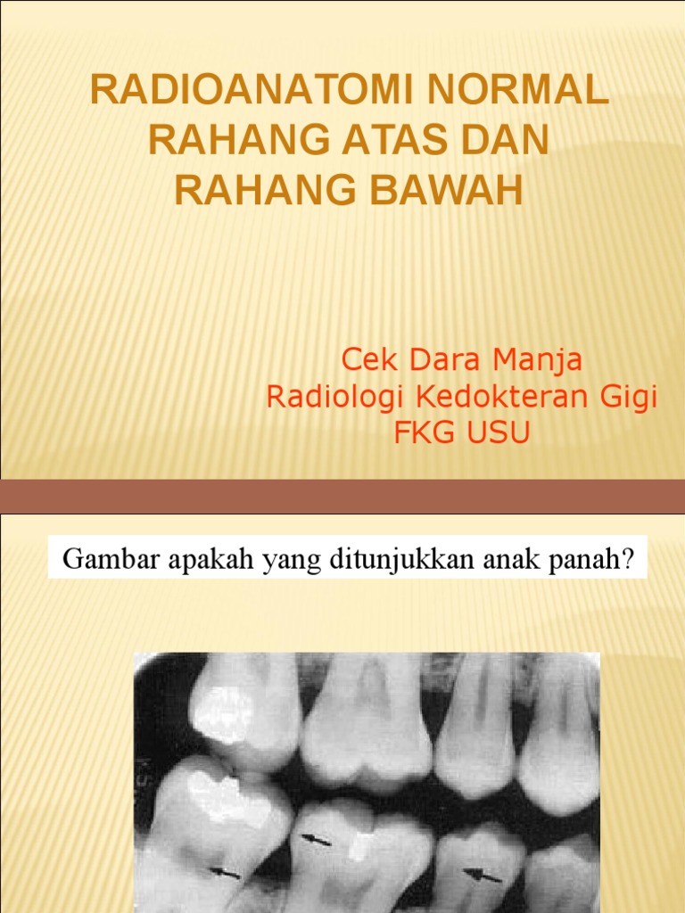 Radiografi Anatomi Rahang Atas dan Bawah | PDF