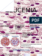 LEUCEMIA para estudiantes