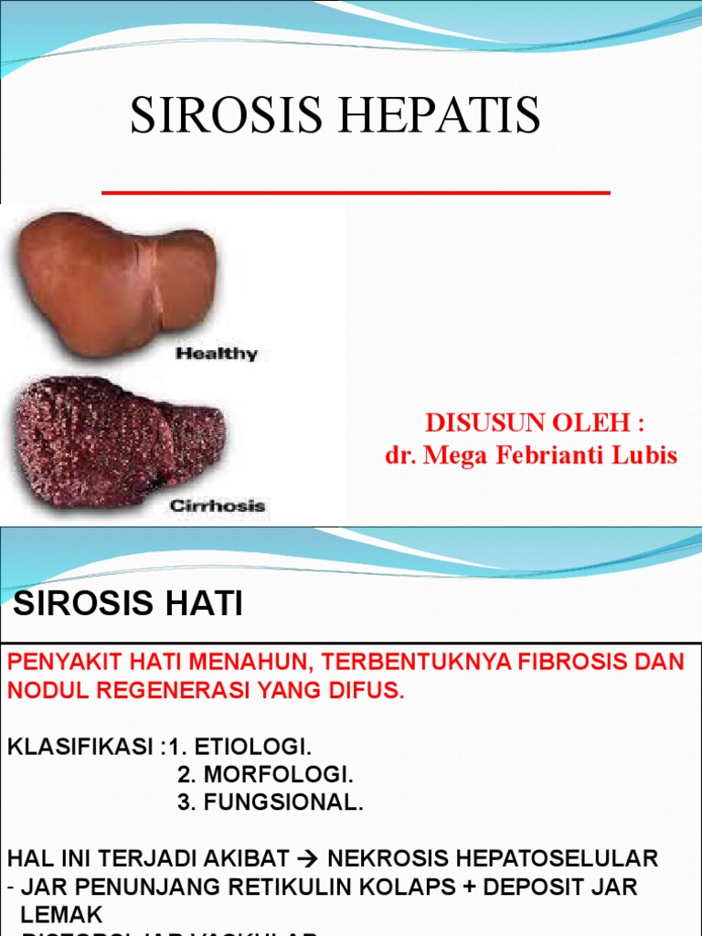 Unduh 960 Koleksi Gambar Hati Sirosis Terbaik Gratis