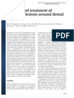 Etiology and treatment of periapical lesions around dental implants.pdf