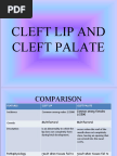 Cleft lip surgery image