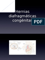 Hernia Diafragmatica