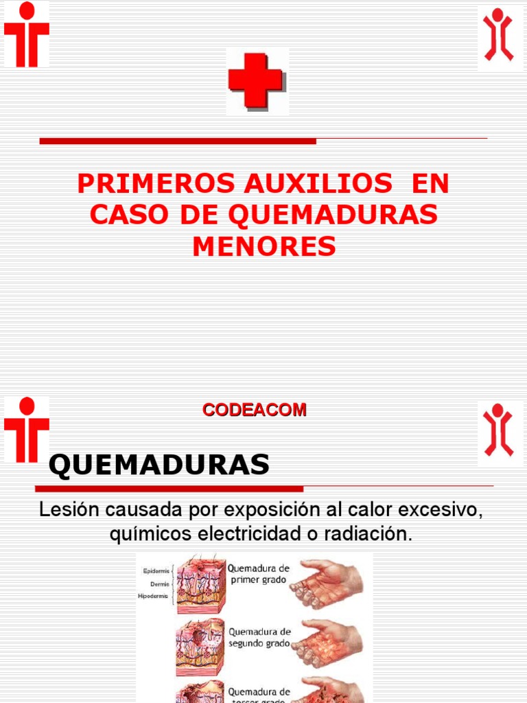 Primeros Auxilios en Quemaduras Menores | PDF