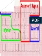 Ecg Topo