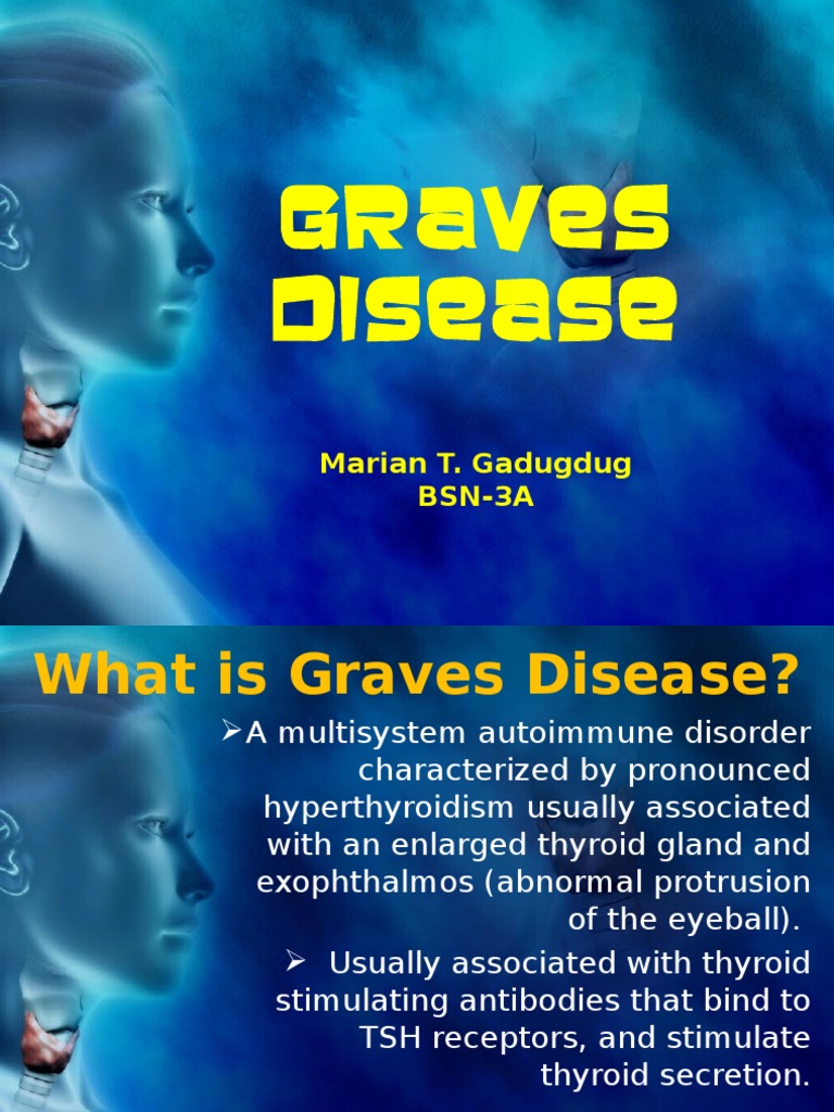 GRAVES DISEASE.ppt Hyperthyroidism Thyroid