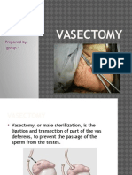 Vasectomy: Prepared By: Group 1