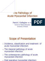 The Pathology of Acute Myocardial Infarction: Patrick J Gallagher