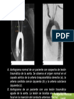 Aortograma