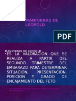 Maniobras de Leopold 