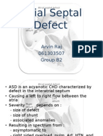 Atrial Septal Defect: Arvin Raj 061303507 Group B2