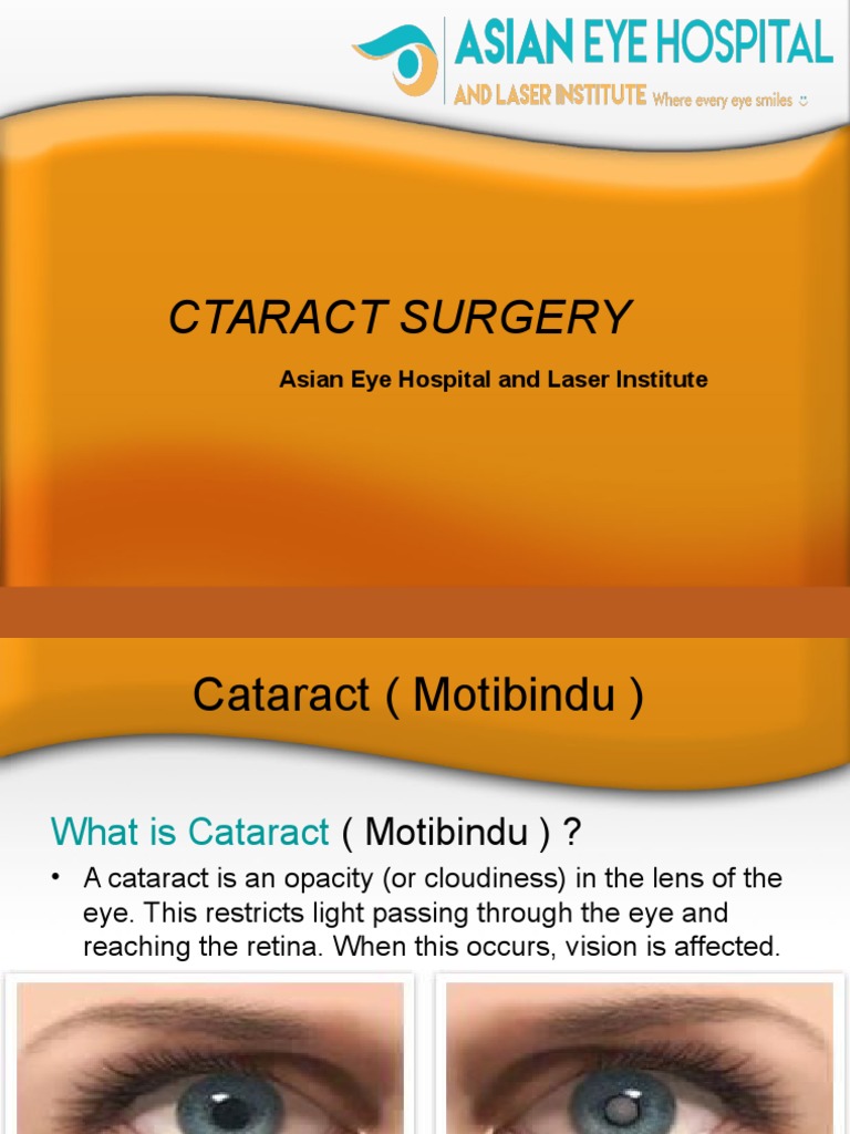 Cataract Surgery Asian Eye Hospital Pdf Ophthalmology Medical