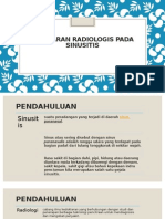 PPT Refrat Radiologi Tami