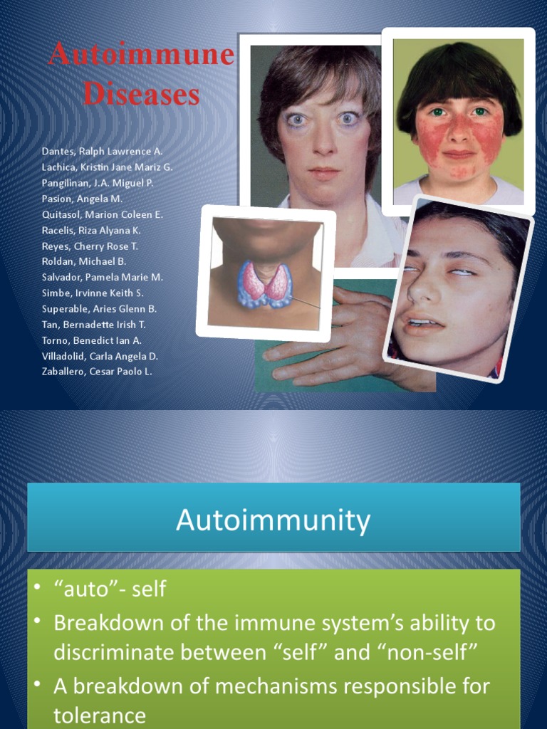 Overview of Autoimmune Diseases | PDF | Immune Tolerance | Autoimmunity