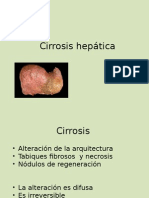 Cirrosis