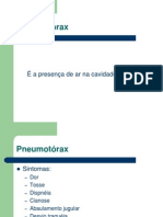 Resumo Pneumotorax e Drenagem Pleural