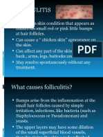 FOLLICULITIS