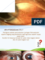 Penyuluhan Pterigium