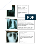 Rangkuman Foto Ujian Radiologi